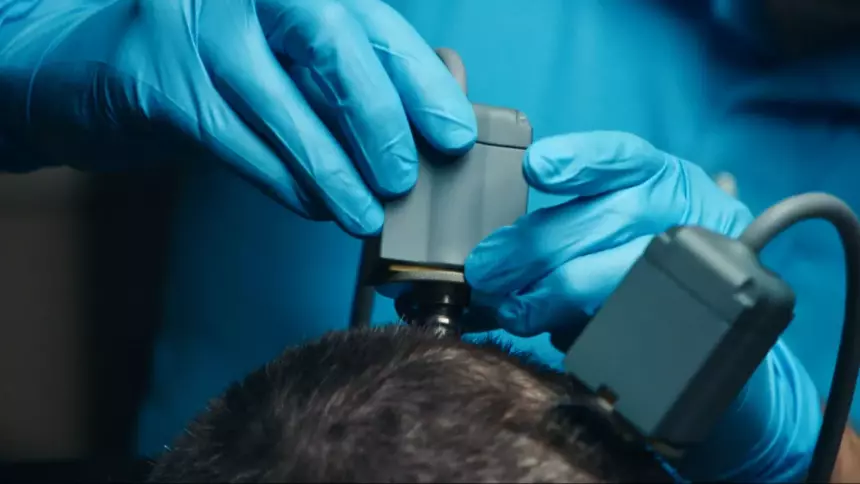 Пять вещей, которые вы неправильно понимаете в нейротехнологиях