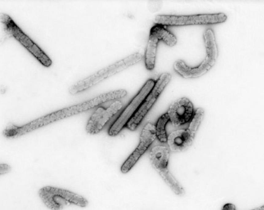 Глава Роспотребнадзора: лихорадка Марбург появилась на неэндемичных территориях
