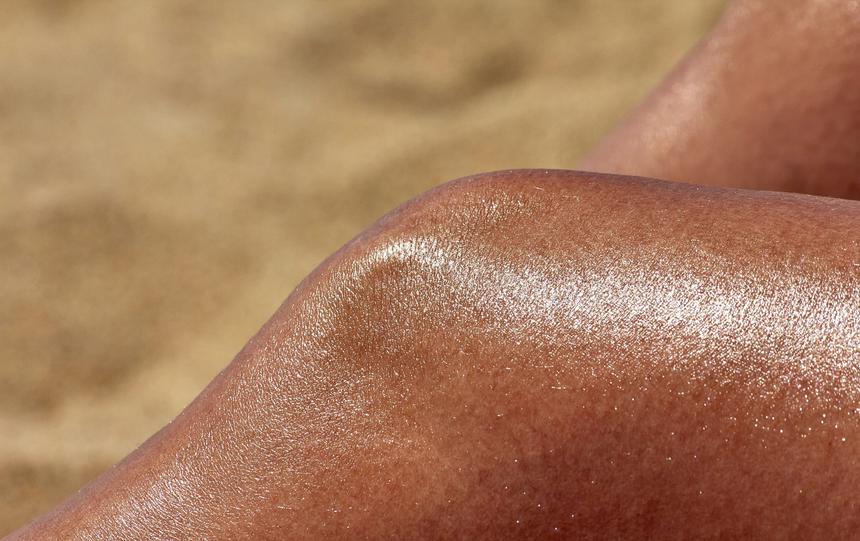 Врач назвала солнечную крапивницу одним из проявлений аллергии на солнце