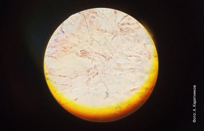 Микроструктуры гельвеллосебацины слипающейся.